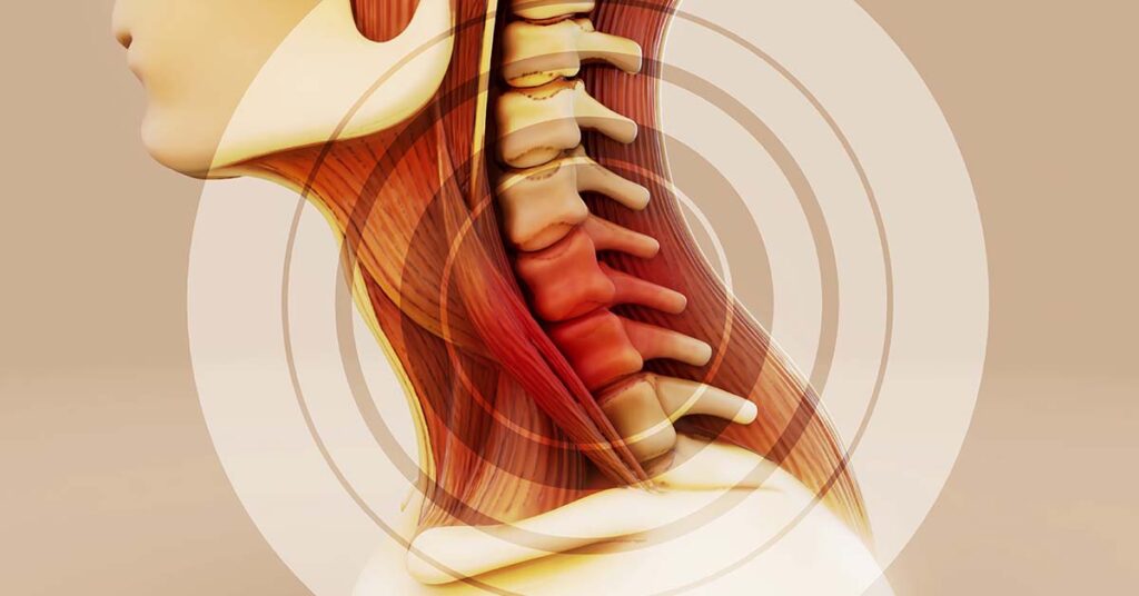 Ortopedista especialista em coluna cervical: tratamentos avançados 1 Ortopedista especialista em coluna cervical: tratamentos avançados